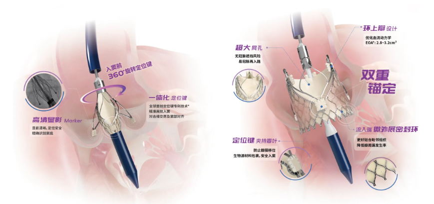 引力播：自动脉瓣反流微创介入治疗实现领跑跨越 旺财28医疗立异产品获批上市